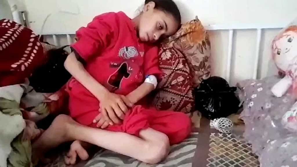 গাজায় অনাহার যুদ্ধাপরাধ বলে বিবেচিত হতে পারে: জাতিসংঘ কর্মকর্তা