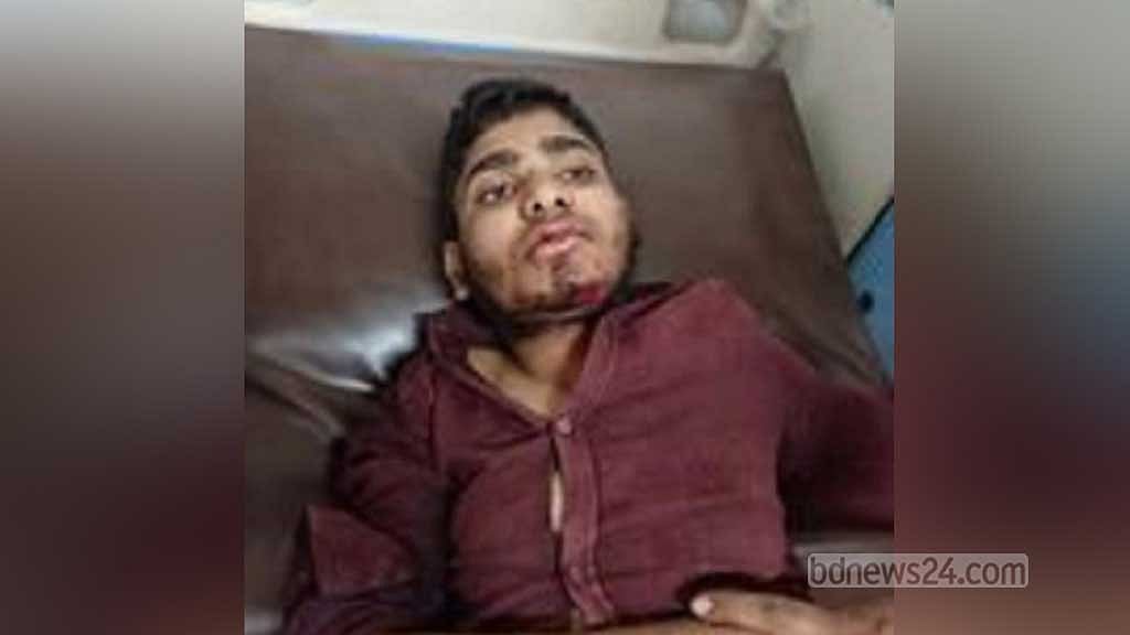 সিলেটে আদালত ভবন থেকে লাফিয়ে আসামির ‘আত্মহত্যার চেষ্টা’