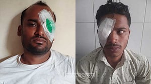 শিব নারায়ণ দাশের কর্নিয়া পেলেন দুজন