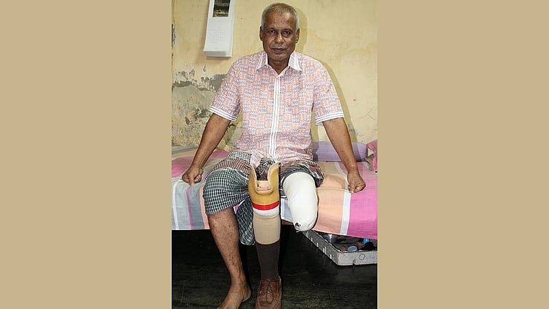 পাকিস্তানি সেনাদের পুঁতে রাখা মাইনের আঘাতে উড়ে যায় নূর ইসলামের বাঁ পায়ের হাঁটুর নিচের অংশ, ছবি: সালেক খোকন।