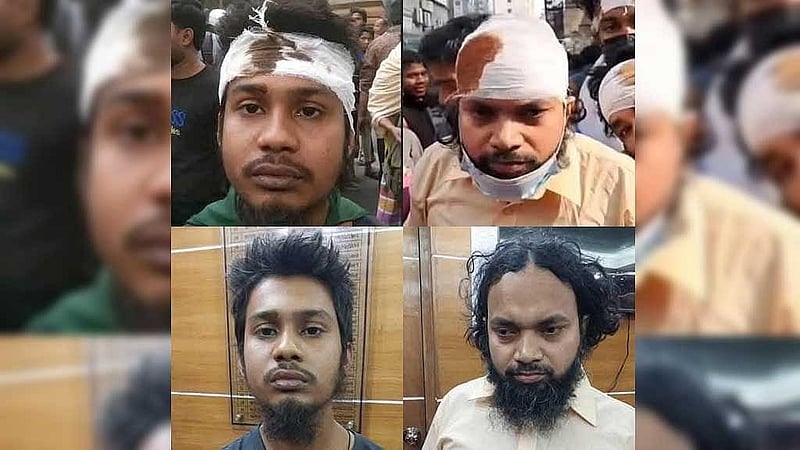 আদিবাসী শিক্ষার্থীদের ওপর হামলার ঘটনার পর আরিফ আল খবির ও আব্বাস নামে দুজনের মাথায় ব্যান্ডেজ দেখা গেলেও তাদের গ্রেপ্তারের পর কোনো আঘাতের চিহ্ন পায়নি পুলিশ। 
