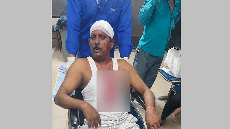 আহত কেশব রঞ্জন সরকার