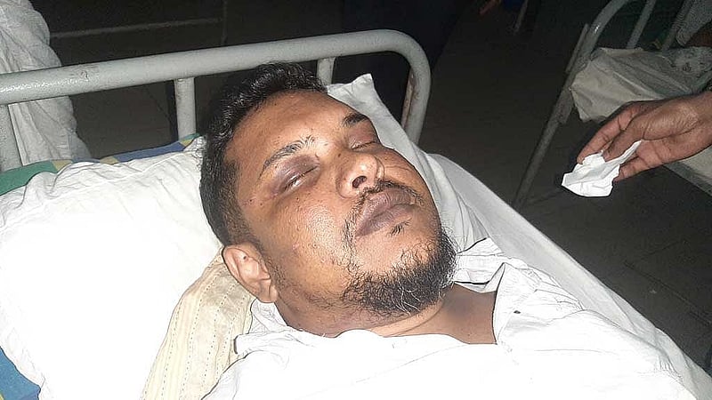 তৌহিদ ভুঁইয়ার এক চোখ পুরোপুরি নষ্ট, আরেকটি ৭০ শতাংশ ক্ষতিগ্রস্ত। সেটিতে দুইবার অপারেশন হয়েছে, তবে আলো ফেরেনি। চোখে আর না দেখলে তিন সন্তানের কী হবে? 
