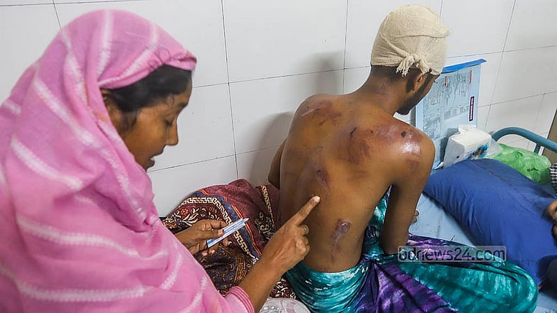 মাহবুবুর রহমান মোল্লা কলেজের শিক্ষার্থীরা পিটিয়ে আহত করেছেন সোহরাওয়ার্দী কলেজের শিক্ষার্থী নাফি উদ্দিনকে। ন্যাশনাল মেডিকেল ইনস্টিটিউট হাসপাতালের কেবিনে চিকিৎসাধীন নাফি উদ্দিনের সেবা করছেন তার মা। ছবি: আব্দুল্লাহ আল মমীন