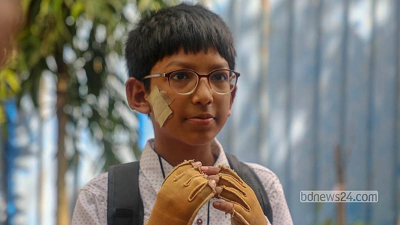 বিমানবাহিনীর প্রশিক্ষণ যুদ্ধবিমান বিধ্বস্তের ঘটনায় আহত হয়েছিলেন শিক্ষার্থী জুনায়েদ। মঙ্গলবার তিনি মাইলস্টোন স্কুল অ্যান্ড কলেজের ক্যাম্পাসে আসেন নিহতদের শ্রদ্ধা জানাতে