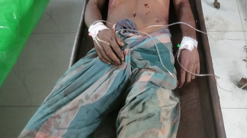 ‘বাবাকে খুঁজে না পেয়ে জানতে পারি, আগুনে গুরুতর আহত হয়েছেন’