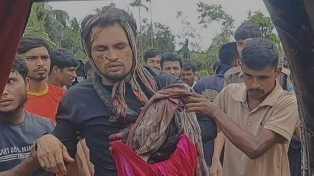 কক্সবাজার হাসপাতাল থেকে হাতকড়াসহ পালালেন রোহিঙ্গা আসামি