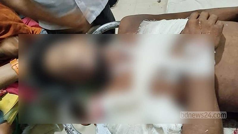 হবিগঞ্জে আন্দোলনকারী-পুলিশের সংঘর্ষ, গুলিতে যুবক নিহত