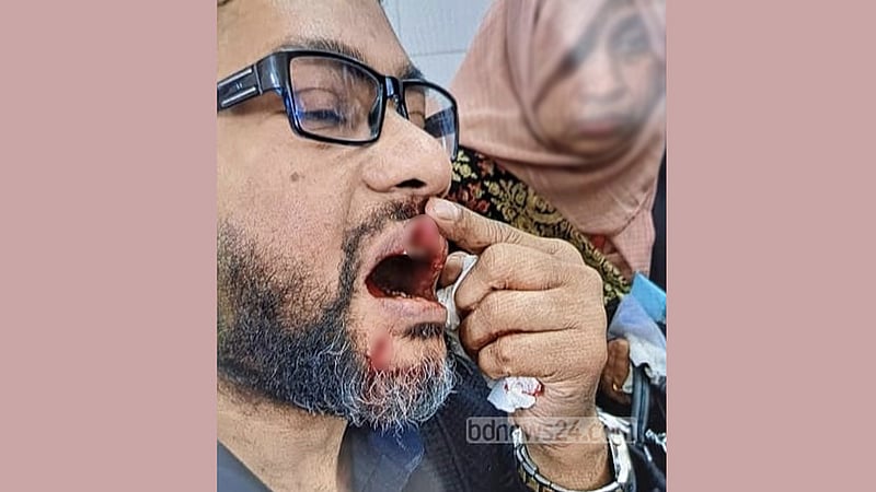 ফরিদপুরে ধাক্কা লাগার জেরে চিকিৎসককে মারধর, ভাঙল দাঁত