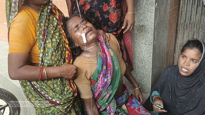 মুন্সীগঞ্জে সাপের কামড়ে গৃহবধূ আহত