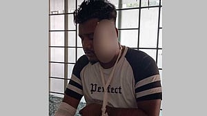নারায়ণগঞ্জে মেয়র প্রার্থীর সমর্থকদের ওপর হামলা, আহত ৩