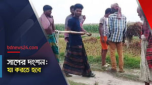 সাপের দংশনে শরীর যেভাবে আক্রান্ত হয়
