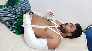 শিক্ষার্থীকে উত্যক্তের প্রতিবাদ করায় শিক্ষকের হাত ভাঙল বখাটেরা