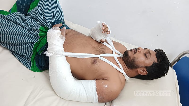 শিক্ষার্থীকে উত্যক্তের প্রতিবাদ করায় শিক্ষকের হাত ভাঙল বখাটেরা