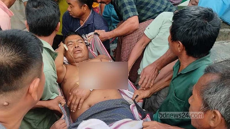 রাঙামাটিতে ইউপি চেয়ারম্যান গুলিতে আহত