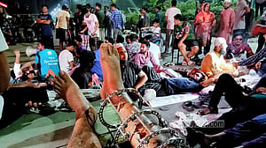 আন্দোলনে আহত: ৫ কর্মদিবসের মধ্যে চিকিৎসার রূপরেখা