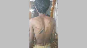 মোহাম্মদপুরে সাংবাদিককে পিটিয়ে ক্যামেরা-মোবাইল ছিনতাই