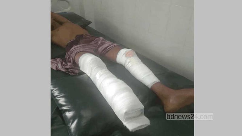 টেকনাফ সীমান্তে মাইন বিস্ফোরণে তরুণ আহত