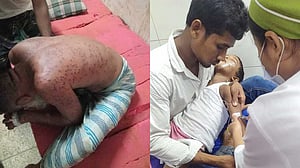 ময়মনসিংহে ভিমরুলের কামড়ে বাবা-মেয়ের পর ছেলেরও মৃত্যু