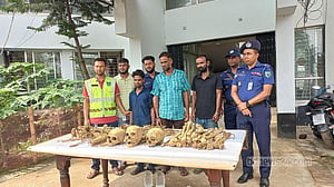 ময়মনসিংহে মানুষের বিপুল কঙ্কালসহ আটক ৩