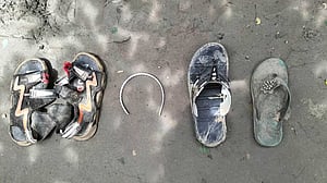 সরেজমিন বামনশিকড় ও অনাহারের ময়নাতদন্ত