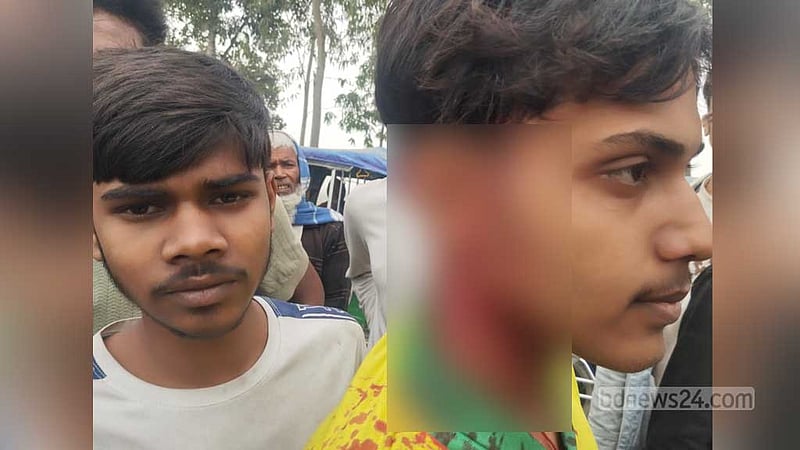 বগুড়ায় যাত্রা-সার্কাস নিয়ে আপত্তি, বিএনপির দুপক্ষের সংঘর্ষে আহত ২