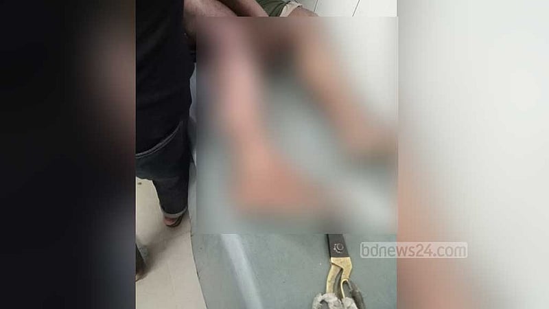 আখেরি মোনাজাতের পর ‘ঠেলাঠেলি’, গরম পানিতে দগ্ধ ৪