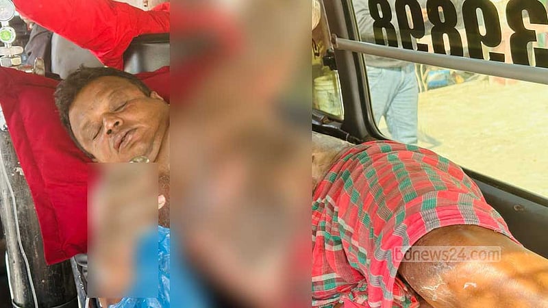 গোপালগঞ্জে এনজিও কর্মীর গায়ে পেট্রোল ঢেলে পুড়িয়ে হত্যার চেষ্টা