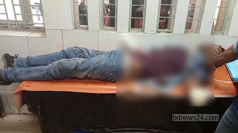 পাবনায় কুপিয়ে যুবকের দুই হাতের কব্জি বিচ্ছিন্ন