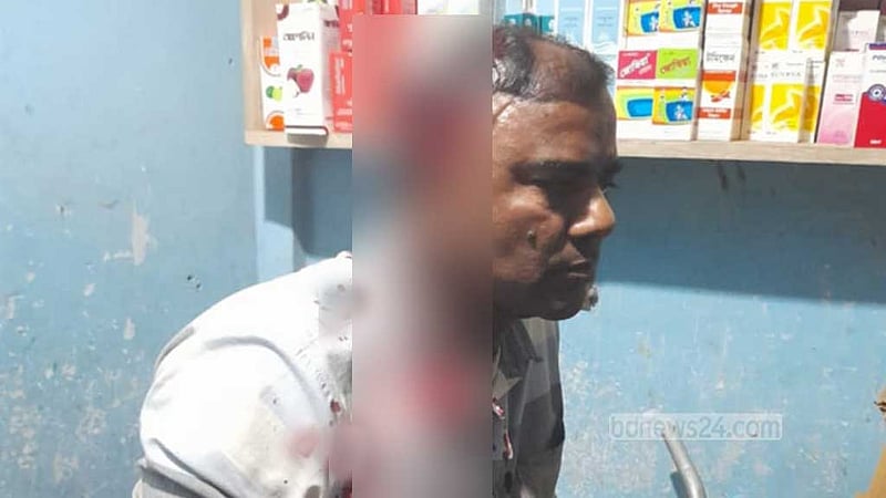 রাঙামাটিতে টিসিবি ডিলারের ওপর অতর্কিত হামলা, জখম