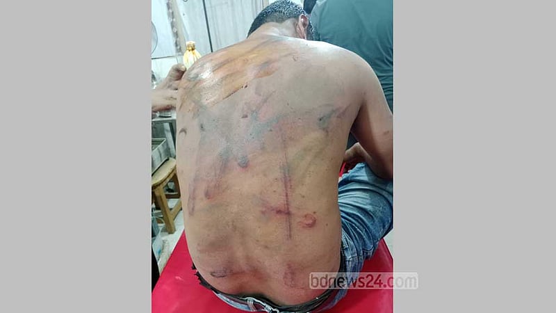 ‘শিক্ষক আওয়ামী লীগ করতেন’, তাই পিটিয়ে স্কুলছাড়া করলেন যুবদল নেতা