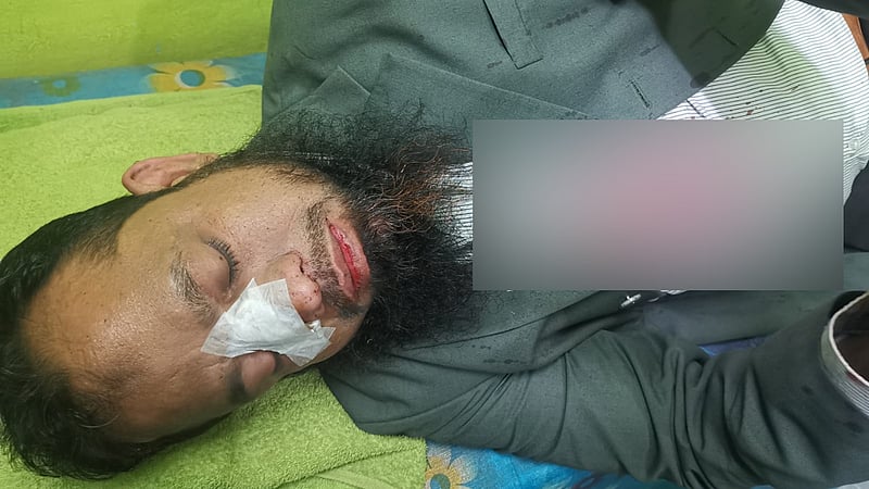 গ্যাসের অবৈধ সংযোগ: অভিযানে গিয়ে রক্তাক্ত তিতাসের কর্মকর্তারা