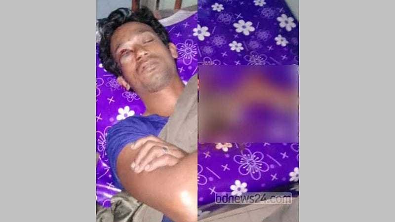 নাটোরে যুবকের চোখে আঘাত-পায়ের রগ কাটার অভিযোগে আটক ১