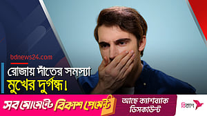 রোজায় দাঁতের সমস্যা, মুখের দুর্গন্ধ- করণীয় কী?