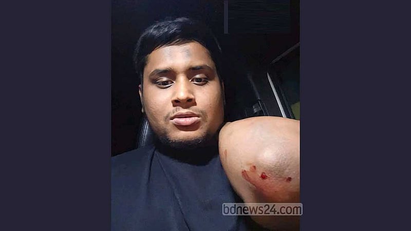 গাজীপুরে হাসনাত আব্দুল্লাহর গাড়িতে হামলা