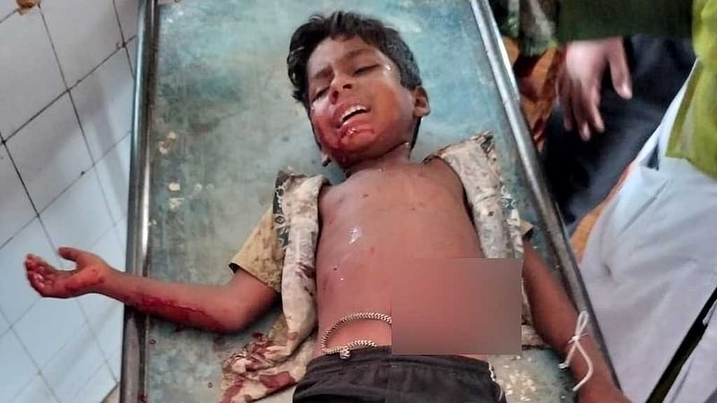 ‘খেলতে গিয়ে কুড়িয়ে পাওয়া’ বোমা বিস্ফোরণে ৩ ভাই-বোন আহত