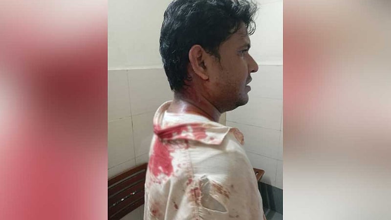 জঙ্গল সলিমপুরে হামলায় ২ সাংবাদিক আহত