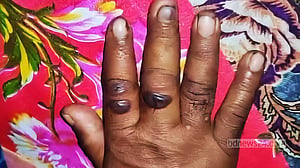 গাইবান্ধায় রোগাক্রান্ত গরু কাটাকাটি করা ১১ জনের দেহে ‘অ্যানথ্রাক্স উপসর্গ’