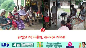 রংপুরের তিন উপজেলায় অ্যানথ্রাক্স শনাক্ত