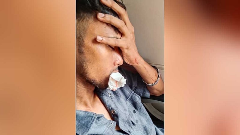 ট্রেনে পাথর নিক্ষেপ: দাঁত ভাঙল এক যাত্রীর, আরেকজনের ঘাড়ে আঘাত
