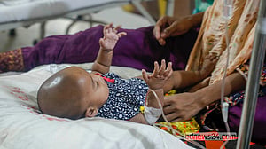হামের উপসর্গ নিয়ে হাসপাতালে শিশুরা