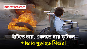 কৃত্রিম পায়ের অপেক্ষায় গাজার হাজারো যুদ্ধাহত