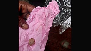 গভীর রাতে চুরি করতে গিয়ে ‘গৃহবধূর কামড়ে’ চোরের আঙুল বিচ্ছিন্ন