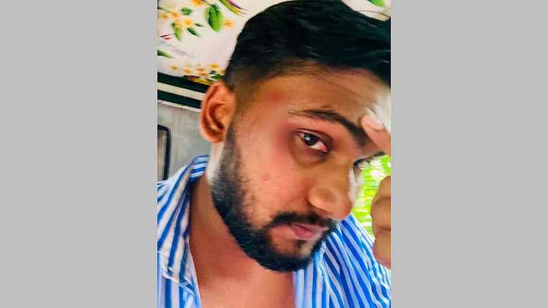 লক্ষ্মীপুরে ‘মাদকবিরোধী কর্মকাণ্ডের জেরে’ ছাত্রদল নেতাকে মারধরের অভিযোগ, মামলা