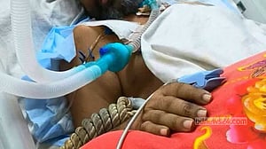হাতকড়াসহ আইসিইউতে থাকা পটুয়াখালীর সেই আওয়ামী লীগ নেতার মৃত্যু
