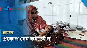নেত্রকোণায় হাম উপসর্গের রোগী হাজার ছাড়িয়েছে