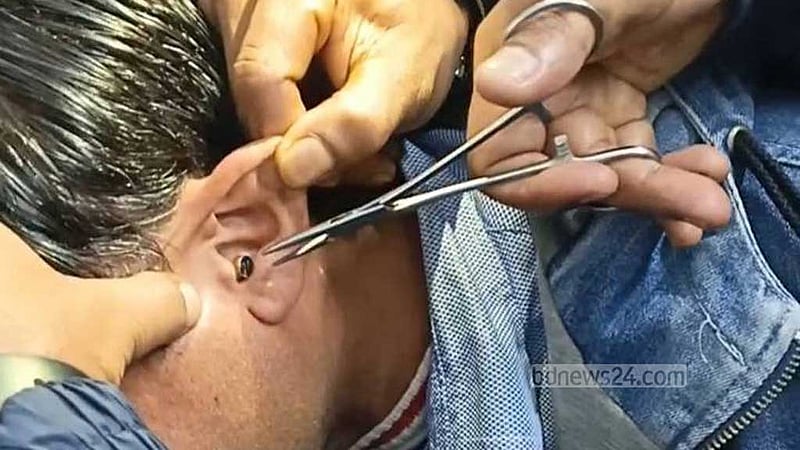 গাইবান্ধায় শিক্ষক নিয়োগ পরীক্ষায় ডিভাইস ব্যবহার, আটক ৫২