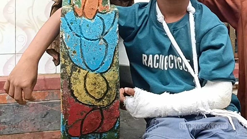 ‘শিক্ষকের বেতের আঘাতে’ হাত ফাটলো মাদ্রাসা ছাত্রের, মুখে গোঁজা হয় কলম