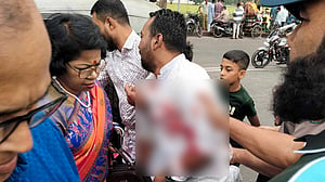 জিয়া উদ্যানে ঘুরতে গিয়ে নিজের শরীরে ব্লেড চালালেন যুবক