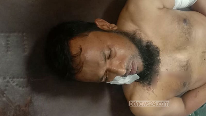 কদমতলীতে দোকানিকে গুলি
